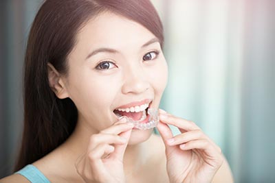 woman putting her Invisalign clear aligners in her mouth